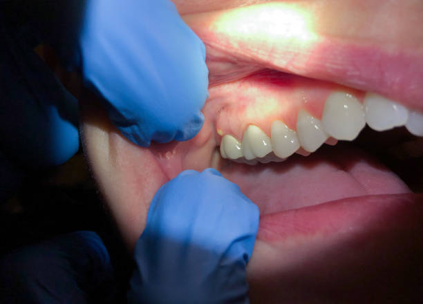 Best Emergency Treatment for Jaw Pain or Injury in Langhorne Manor, PA