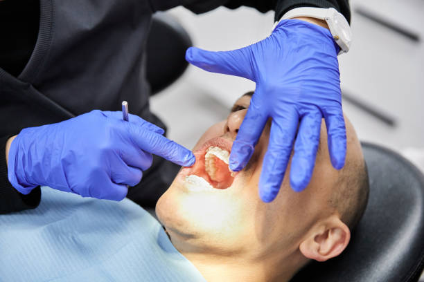 Best Emergency Dental Care for Sports Injuries in Langhorne Manor, PA